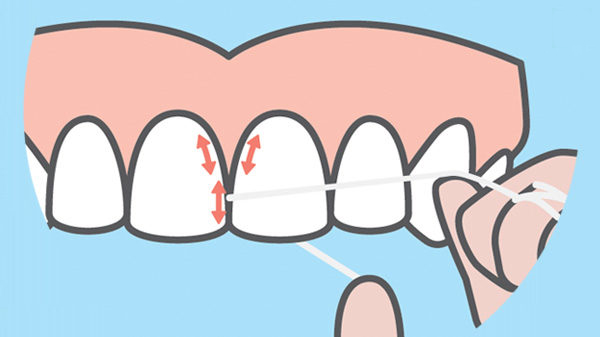 珠海牙科-怎樣正確使用牙線？